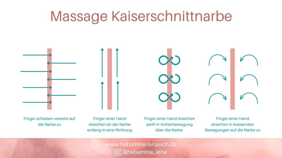 Bild mit Anleitungen Massage Kaiserschnittnarbe